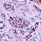 Autophagy Related 3 antibody, orb75436, Biorbyt, Immunohistochemistry paraffin image 