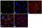 Proteasome 26S Subunit, Non-ATPase 7 antibody, PA1-1963, Invitrogen Antibodies, Immunofluorescence image 