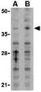 MCL1 Apoptosis Regulator, BCL2 Family Member antibody, GTX31709, GeneTex, Western Blot image 