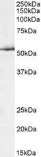 Glucokinase antibody, CL8880AP, Cedarlane Labs, Western Blot image 