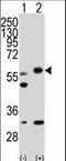 Serine/Threonine Kinase 11 antibody, LS-C100773, Lifespan Biosciences, Western Blot image 