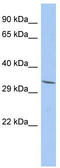 Family With Sequence Similarity 78 Member A antibody, TA333582, Origene, Western Blot image 