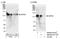 Protein Phosphatase 6 Regulatory Subunit 3 antibody, NB100-41417, Novus Biologicals, Western Blot image 