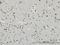 Ribosomal Protein S6 Kinase A2 antibody, H00006196-M01, Novus Biologicals, Immunohistochemistry frozen image 