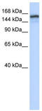 Tonsoku Like, DNA Repair Protein antibody, TA330108, Origene, Western Blot image 