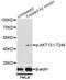 AKT1 Substrate 1 antibody, LS-C750601, Lifespan Biosciences, Western Blot image 