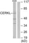 Ceramide Kinase Like antibody, abx013647, Abbexa, Western Blot image 