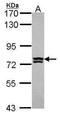 Arginyl Aminopeptidase antibody, GTX114721, GeneTex, Western Blot image 