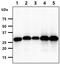 Four And A Half LIM Domains 2 antibody, GTX57719, GeneTex, Western Blot image 
