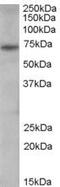 Peptidyl Arginine Deiminase 4 antibody, PA5-18318, Invitrogen Antibodies, Western Blot image 