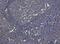 Major Histocompatibility Complex, Class II, DR Alpha antibody, M01195-3, Boster Biological Technology, Immunohistochemistry paraffin image 