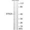 Serine/Threonine Kinase 24 antibody, A04112, Boster Biological Technology, Western Blot image 