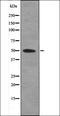 EPH Receptor B1 antibody, orb335813, Biorbyt, Western Blot image 