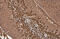 Phosphoglycerate Kinase 1 antibody, GTX634447, GeneTex, Immunohistochemistry paraffin image 