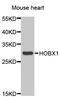Homeobox B1 antibody, A6619, ABclonal Technology, Western Blot image 