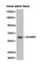 Scavenger Receptor Class B Member 1 antibody, LS-C192721, Lifespan Biosciences, Western Blot image 