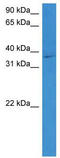 STEAP Family Member 1 antibody, TA341709, Origene, Western Blot image 