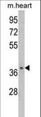 Fructose-Bisphosphatase 2 antibody, LS-C166065, Lifespan Biosciences, Western Blot image 