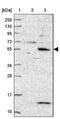 Kelch Repeat And BTB Domain Containing 11 antibody, NBP2-14728, Novus Biologicals, Western Blot image 