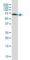 Endoplasmic Reticulum Oxidoreductase 1 Alpha antibody, H00030001-M01, Novus Biologicals, Western Blot image 