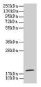 Tubulin Polymerization Promoting Protein Family Member 2 antibody, CSB-PA024116LA01HU, Cusabio, Western Blot image 