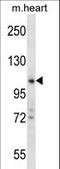 Zinc Finger CCHC-Type Containing 14 antibody, LS-C160743, Lifespan Biosciences, Western Blot image 