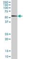 DNA Damage Inducible 1 Homolog 1 antibody, H00414301-B01P, Novus Biologicals, Western Blot image 