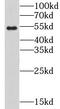 Cholinergic Receptor Nicotinic Beta 1 Subunit antibody, FNab01682, FineTest, Western Blot image 