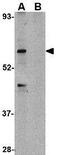 Tripartite Motif Containing 25 antibody, GTX31323, GeneTex, Western Blot image 