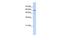 Glutamate Dehydrogenase 2 antibody, GTX45374, GeneTex, Western Blot image 