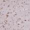 Protein Kinase C And Casein Kinase Substrate In Neurons 3 antibody, NBP2-47339, Novus Biologicals, Immunohistochemistry paraffin image 