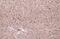 Ketohexokinase antibody, GTX109591, GeneTex, Immunohistochemistry paraffin image 