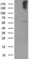 Cytochrome P450 Family 2 Subfamily J Member 2 antibody, MA5-25705, Invitrogen Antibodies, Western Blot image 
