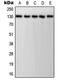 Platelet And Endothelial Cell Adhesion Molecule 1 antibody, MBS821613, MyBioSource, Western Blot image 