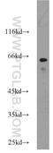 Mitogen-Activated Protein Kinase Kinase Kinase 7 antibody, 12330-2-AP, Proteintech Group, Western Blot image 