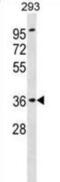 ATPase H+ Transporting Accessory Protein 2 antibody, abx031309, Abbexa, Western Blot image 