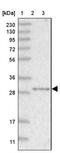 Nitrilase Family Member 2 antibody, NBP1-89486, Novus Biologicals, Western Blot image 