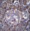 Cyclin-dependent kinase inhibitor 2A antibody, LS-C164218, Lifespan Biosciences, Immunohistochemistry paraffin image 