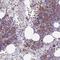 Cytidine Deaminase antibody, NBP2-39019, Novus Biologicals, Immunohistochemistry frozen image 
