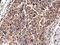 Tubulin Gamma 1 antibody, PA5-34815, Invitrogen Antibodies, Immunohistochemistry paraffin image 
