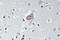 ABL Proto-Oncogene 1, Non-Receptor Tyrosine Kinase antibody, LS-C178006, Lifespan Biosciences, Immunohistochemistry frozen image 