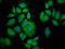 Platelet Activating Factor Acetylhydrolase 1b Catalytic Subunit 3 antibody, LS-C670947, Lifespan Biosciences, Immunofluorescence image 