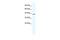 Potassium Two Pore Domain Channel Subfamily K Member 13 antibody, GTX47655, GeneTex, Western Blot image 