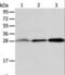AlkB Homolog 2, Alpha-Ketoglutarate Dependent Dioxygenase antibody, LS-C401144, Lifespan Biosciences, Western Blot image 