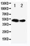 Fms Related Tyrosine Kinase 3 Ligand antibody, PA5-79271, Invitrogen Antibodies, Western Blot image 