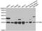 Deoxythymidylate Kinase antibody, LS-C334667, Lifespan Biosciences, Western Blot image 