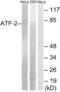 Activating Transcription Factor 2 antibody, LS-C198648, Lifespan Biosciences, Western Blot image 