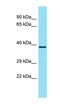 Transmembrane Protein 121 antibody, orb326817, Biorbyt, Western Blot image 