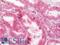 Endoplasmic Reticulum Protein 29 antibody, LS-B12253, Lifespan Biosciences, Immunohistochemistry paraffin image 