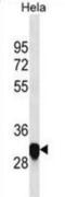 Proteolipid Protein 1 antibody, abx025509, Abbexa, Western Blot image 